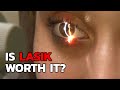 LASIK Laser Eye Surgery: A Comprehensive Guide